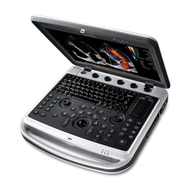УЗИ аппарат Chison SonoTouch 80 (SonoBook 8)
