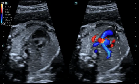 УЗИ аппарат Mindray Consona N8 фото 18
