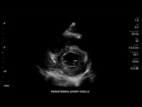 Мобильная ультразвуковая система Philips Lumify фото 10