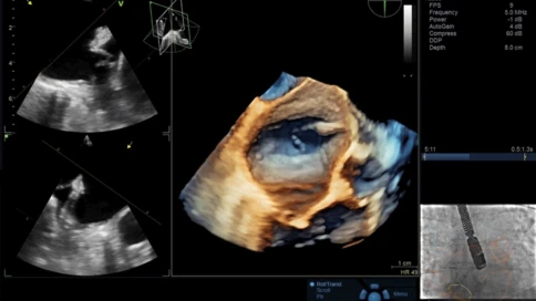 Ультразвуковая диагностическая система GE Healthcare Vivid S70 фото 5