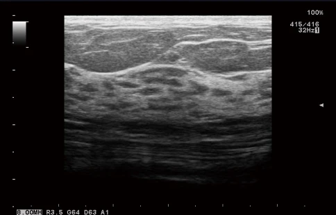УЗИ аппарат Fujifilm Lisendo 880LE фото 7