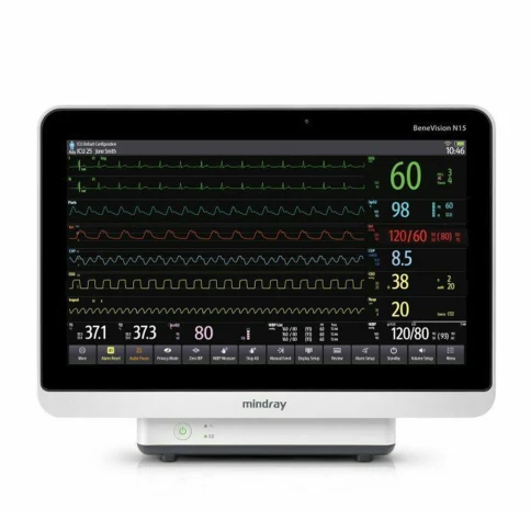 Монитор пациента Mindray BeneVision N15 фото 1