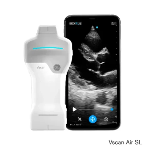 УЗИ аппарат GE HealthCare Vscan Air фото 2