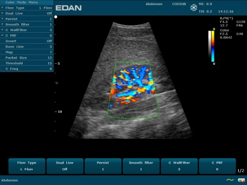 УЗИ аппарат Edan U50 Prime Edition фото 34