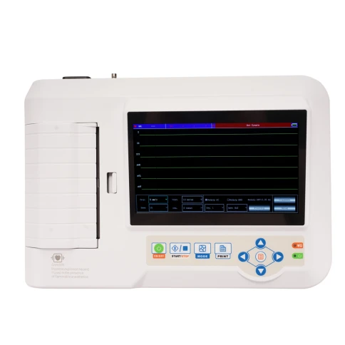 Электрокардиограф Med-Mos ECG600G — компактный 6-канальный аппарат для эффективной диагностики сердца в больницах, клиниках и амбулаториях фото 1