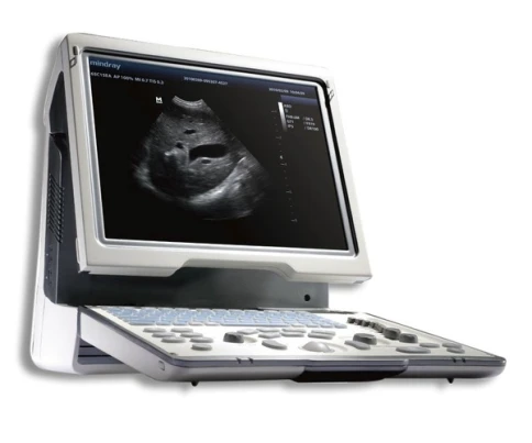 УЗИ аппарат Mindray DP-50 Vet фото 2