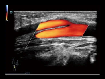 УЗИ аппарат Mindray Resona R9 фото 16