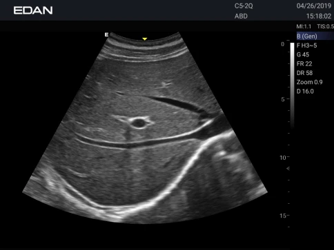 УЗИ аппарат Edan Acclarix AX3 фото 45
