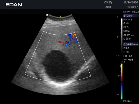 УЗИ аппарат Edan Acclarix AX3 фото 42