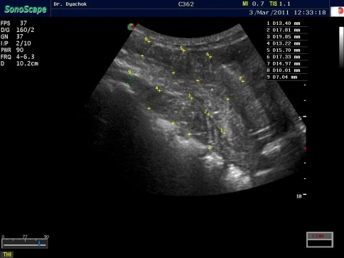 Ультразвуковой аппарат SonoScape S8Exp фото 6