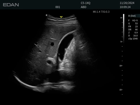 Ультразвуковая система Edan Acclarix LX85 фото 9