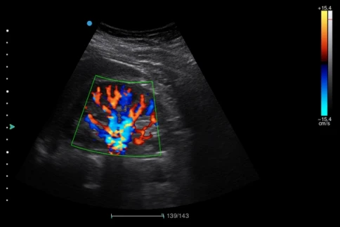 Ультразвуковой аппарат SIUI Apogee 1100 фото 8