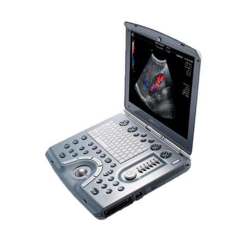 Портативный ультразвуковой сканер GE Healthcare Voluson I фото 3