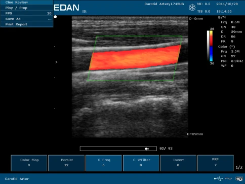 УЗИ аппарат Edan U50 Prime Edition фото 12