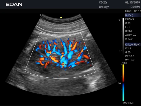 УЗИ аппарат Edan Acclarix AX3 фото 44