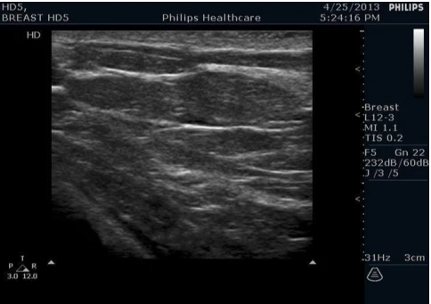УЗИ аппарат Philips HD5 фото 9
