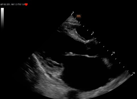 УЗИ аппарат Mindray Recho R9 фото 23
