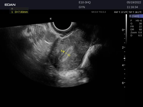УЗИ аппарат Edan Acclarix LX9 фото 26