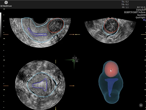 УЗИ аппарат GE HealthCare Voluson Expert 20 фото 4