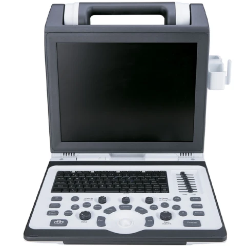 Портативный ультразвуковой сканер SIUI CTS 7700 2 датчика фото 2