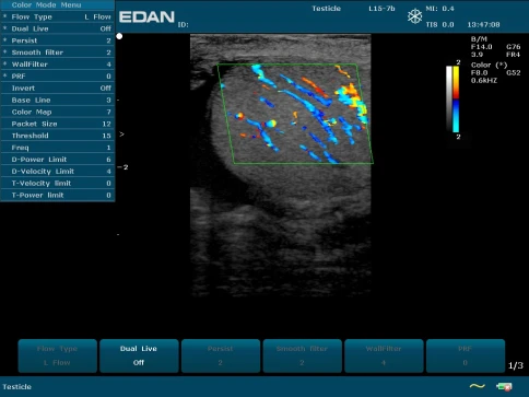 УЗИ аппарат Edan U50 Prime Edition фото 9