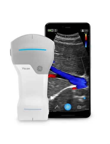 УЗИ аппарат GE HealthCare Vscan Air фото 1