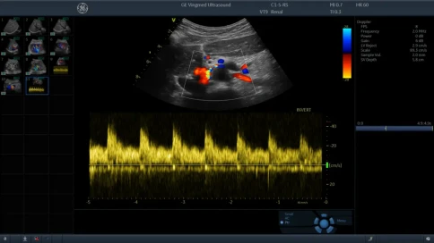 Ультразвуковая диагностическая система GE Healthcare Vivid T8 фото 13