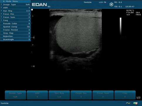 УЗИ аппарат Edan U50 Prime Edition фото 11
