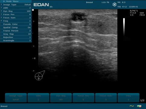 УЗИ аппарат Edan U50 Prime Edition фото 7
