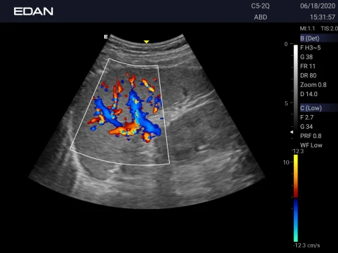 УЗИ аппарат Edan Acclarix AX3 фото 46