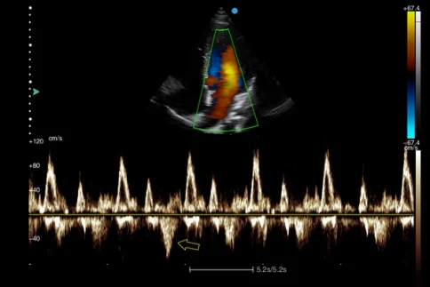 Ультразвуковой аппарат SIUI Apogee 1100 фото 7