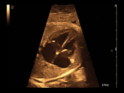 УЗИ аппарат Esaote MyLab Alpha фото 16