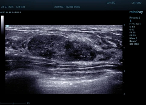УЗИ аппарат Mindray Resona 6 Exp фото 6