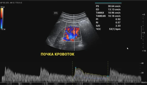 Ультразвуковой аппарат Mindray Resona I9 Exp фото 11