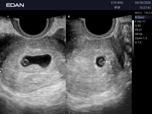 УЗИ аппарат Edan Acclarix AX3 фото 23