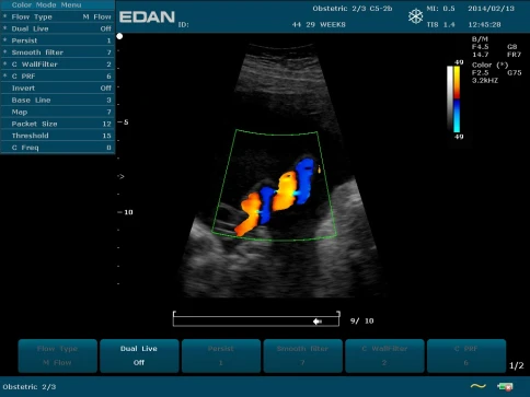 УЗИ аппарат Edan U50 Prime Edition фото 30