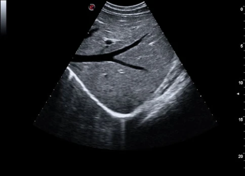 УЗИ аппарат Esaote MyLab Gamma фото 7
