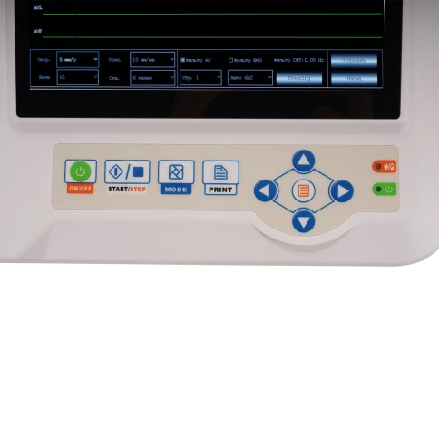 Электрокардиограф Med-Mos ECG600G — компактный 6-канальный аппарат для эффективной диагностики сердца в больницах, клиниках и амбулаториях фото 4