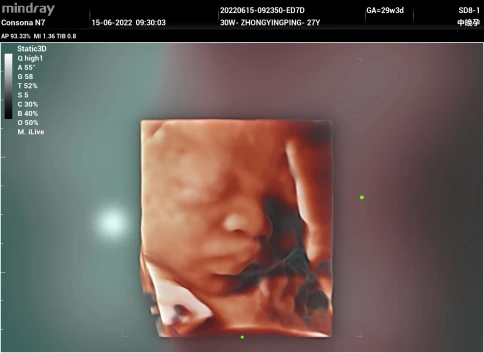 Ультразвуковая система Mindray Consona N7P фото 29