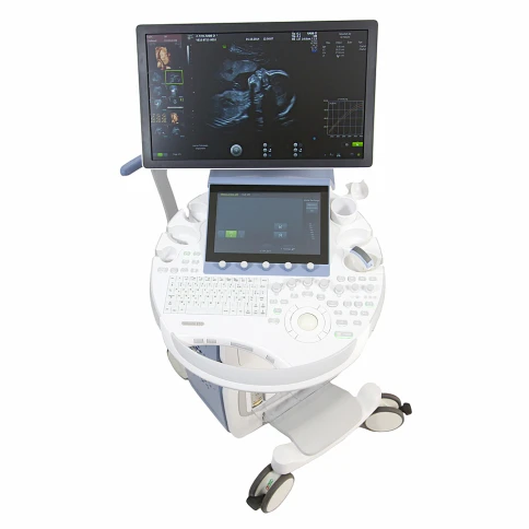 Ультразвуковая диагностическая система GE Healthcare Voluson E10 фото 4