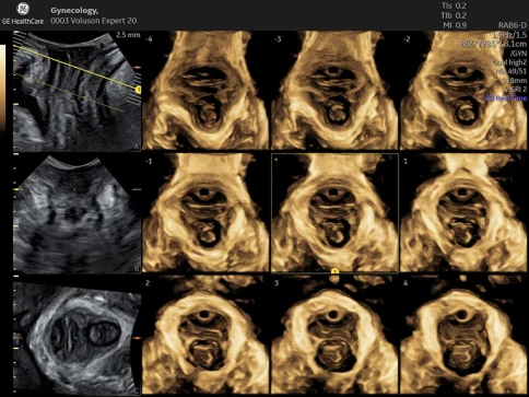 УЗИ аппарат GE HealthCare Voluson Expert 20 фото 11