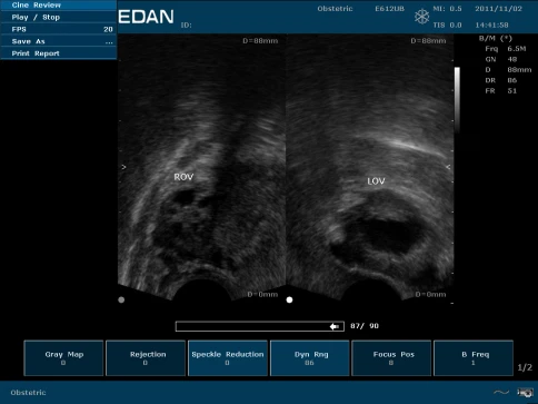 УЗИ аппарат Edan U50 Prime Edition фото 46