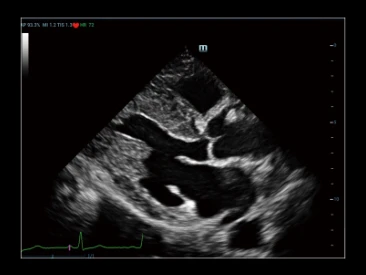 УЗИ аппарат Mindray Resona R9 фото 19