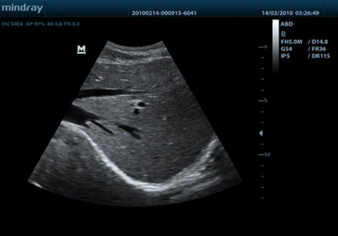 УЗИ аппарат Mindray DP-50 Vet фото 5