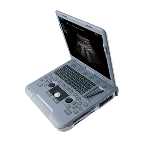 УЗИ аппарат SIUI Apogee 1000 Neo фото 1