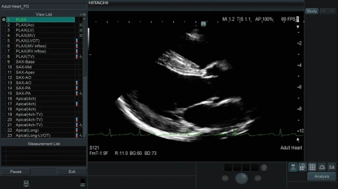УЗИ аппарат Fujifilm Lisendo 880LE фото 8