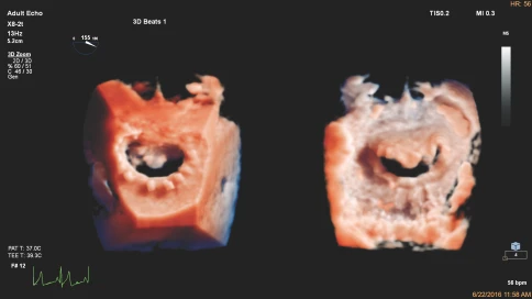 УЗИ аппарат Philips EPIQ CVx фото 9
