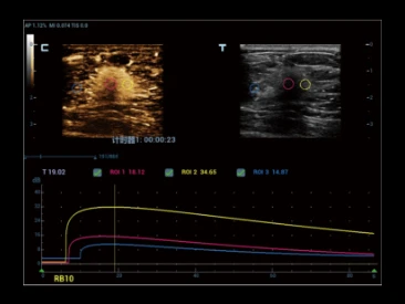 УЗИ аппарат Mindray Resona R9 фото 11