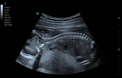 УЗИ аппарат Mindray Consona N6 фото 9