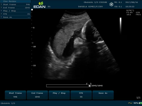 УЗИ аппарат Edan U50 Prime Edition фото 23